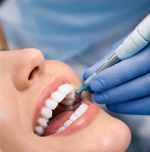 Профессиональная гигиена полости рта